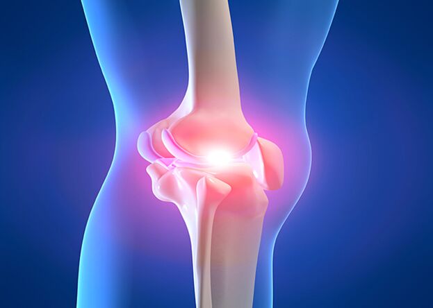 joint pain due to osteoarthritis of the knee