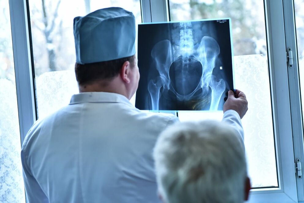 The doctor examines a photo of a hip joint with arthrosis